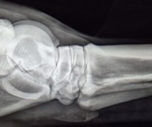 Radiografia del garretto, proiezione latero-laterale