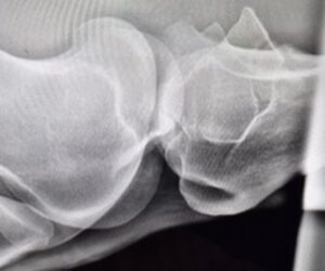 Radiografia della grassella, proiezione latero-laterale